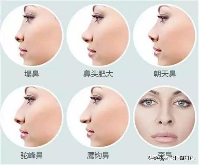 女人鼻型大致分为5种，哪三种好看，哪两种丑看看你是哪种？