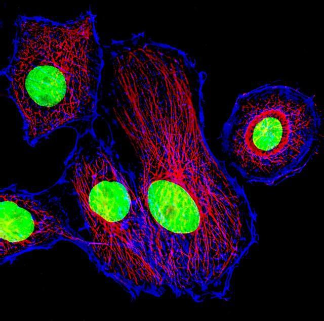 巨蟹座成为流量明星,能撑多久?